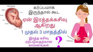 Bleeding during pregnancy in tamilimplementation bleeding in tamil [upl. by Llennej]