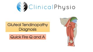 Classic Gluteal Tendinopathy Diagnosis  Clinical Physio [upl. by Mccomb]