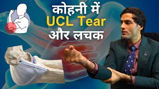 कोहनी में लिगामेंट इंजरी और लचक  Elbow Ulnar Collateral Ligament UCL Tear Treatment [upl. by Nora]