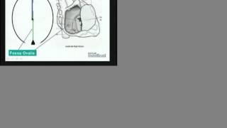 USMLE  Embryology of Heart  Part 1 [upl. by Kale]