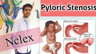 Pediatric Nursing  GERD and Hypertrophic Pyloric Stenosis [upl. by Loria]