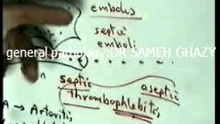 general pathology 7 toxaemia septicaemiapyaemiabacteraemia  repair1 by DR SAMEH GHAZY [upl. by Avlis]