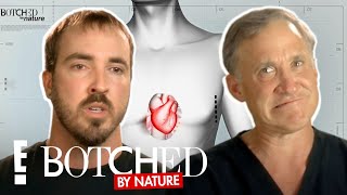 Brandons Chest Bubble Trouble FULL TRANSFORMATION  Botched By Nature  E [upl. by Keldah]