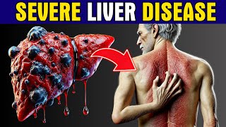 11 Strange Signs of LIVER DAMAGE Healthy Care [upl. by Cecile]