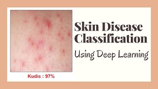 Skin Disease Classification Using Deep Learning Python [upl. by Jarid]