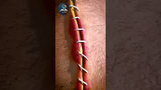 🤯Unbelievable Wound Healing3d animation shorts [upl. by Elletsirk]