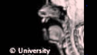 MRI uvular fricative [upl. by Isborne]