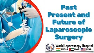 Past Present and Future of Laparoscopic Surgery  Introduction of Minimal Access Surgery [upl. by Nirol926]