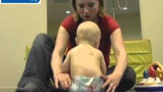 Torticollis and the Importance of Tummy Time Meet Jonathan [upl. by Nylasoj]