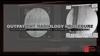 INTERVENTIONAL RADIOLOGY PROCEDURE  ANGIOGRAM  MVI OBL  Paul Davis MD amp David Esposito MD [upl. by Aener810]