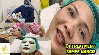 Facial IPL Iontophoresis Peeling Masker di Younger Looks Poris [upl. by Patsis]