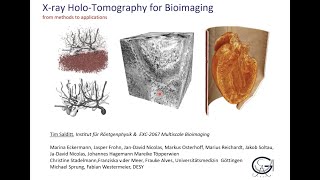 Holographic tomography as a new tool for bioimaging and 3d Virtual Patho‐Histology of Lung Tissue [upl. by Johppa190]