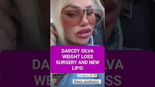 Darcey Silva gets weight loss surgery and new lips after getting the old lips dissolved 90dayfiance [upl. by Lezti]