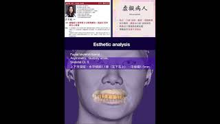 Virtual patient esthetic analysis [upl. by Guibert]