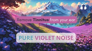 VIOLET NOISE Remove Tinnitus from your ear  PURE violet noise [upl. by Fitz]