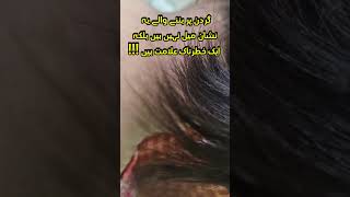 Whats Behind the Black Neck Acanthosis Nigricans Causes Symptoms amp Cure [upl. by Boothe]