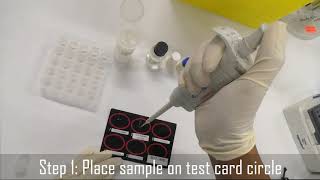 Demo Hemostasis DDimer test Copyright pending [upl. by Nillad]