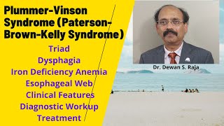 PlummerVinson Syndrome PatersonBrownKelly Syndrome [upl. by Valera]