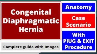 Congenital Diaphragmatic Hernia made easy mbbs newbornneonatology neetpg pediatrics cdh [upl. by Airrotal]