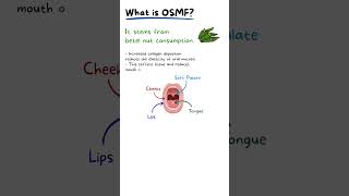 Oral Submucosis Fibrosis Explained [upl. by Rudd]