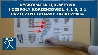 Dyskopatia lędźwiowa  Przepuklina  Zespół korzeniowy L4 L5 S1  Ból brak czucia niedowład I 🇵🇱 🇪🇺 [upl. by Beane844]