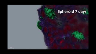 3D cell culture breast cancer cell line  MCF 7 [upl. by Conte]