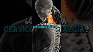 ➡️ ¿Qué es la cervicobraquialgia 🤔 fisioterapiatualcance [upl. by Ieso545]