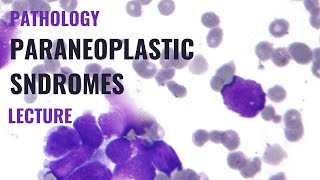 Paraneoplastic syndromes  Detailed explanation [upl. by Berkow]