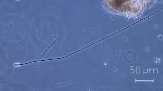 More about Lacrymaria sp a very weird ciliate [upl. by Ymmaj66]