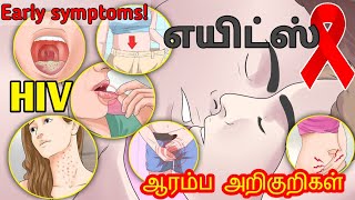 AIDS symptoms in TamilAIDS in Tamilhiv explained in tamilaids explained tamilhiv symptoms tamil [upl. by Mariejeanne]