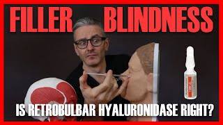 FILLER BLINDNESS Should you do retrobulbar hyaluronidase injection Aesthetics Mastery Show [upl. by Broeker284]