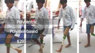 ReMotion Designs Introduction Video  The 20 JaipurKnee for Above Knee Amputees [upl. by Zerep]