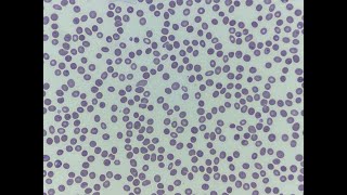 Plasmodium falciparum [upl. by Ailey]