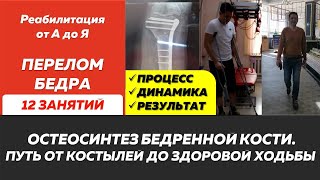 Сложный перелом бедра Остеосинтез Реабилитация после перелома и операции Кинезиотерапия [upl. by Oznol]