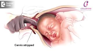 Methods of Labour Induction  Dr Padmini Isaac  Cloudnine Hospitals [upl. by Lenny347]