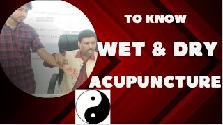 TO KNOW WET amp DRY ACUPUNCTURE [upl. by Gombosi]