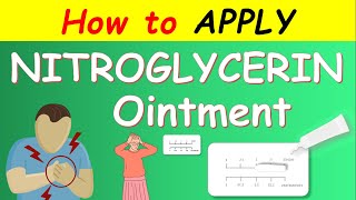 Nitroglycerin ointment  How to apply [upl. by Antebi]