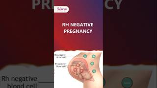 RH Negative Pregnancy  Dr Debashish Sarkar drdebashishsarkar sarkarhospital rhnegativepregnancy [upl. by Ayoj628]