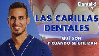 ¿Te vas a hacer CARILLAS DENTALES  Antes deberías de ver esto  ¿Cuales son mejores  Dentalk © [upl. by Novrej]