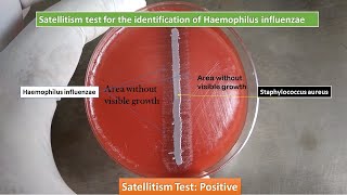 Satellitism Test for Identification of Haemophilus influenzae Satellitism Test Positive [upl. by Mercado194]