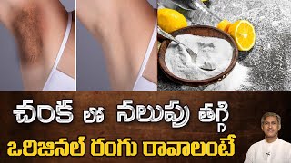 How to Get Rid of Dark Underarms  Remedy to Lighten your Armpits  Dr Manthenas Beauty Tips [upl. by Aicnatsnoc]