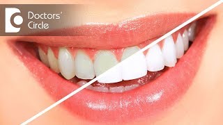 Teeth cleaning vs teeth whitening  Dr Sumanth M Shetty [upl. by Lehsreh]