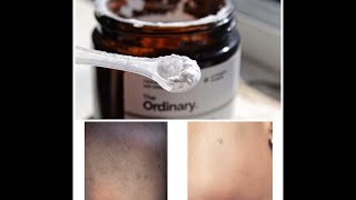 How to use the Ordinary LAscorbic Acid Powder For Bright Glowing Skin 2019 [upl. by Quin914]