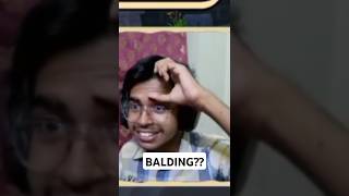 AM I BALDING GUYS genshinimpact streamerclips [upl. by Rayle491]