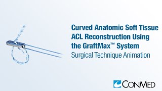 Curved Anatomic Soft Tissue ACL Reconstruction Using the GraftMax™ System  CONMED Animation [upl. by Lynda]