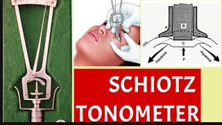 Schiotz Tonometry parts principle procedure and disadvantages [upl. by Anagrom]