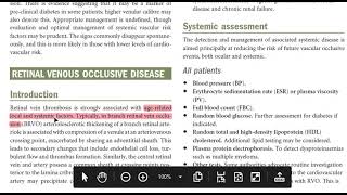 Kanski Clinical Ophthalmology Made Easy  Retina 4 [upl. by Warchaw]