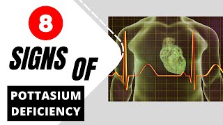 Potassium Deficiency  8 Warning Signs That You Have Low Pottasium [upl. by Madelon]