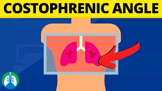 Costophrenic Angle Medical Definition  Quick Explainer Video [upl. by Ahsikal]