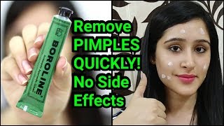 Remove PIMPLES amp ACNE IN 3 DAYS  NATURAL amp EASY METHOD [upl. by Duncan]